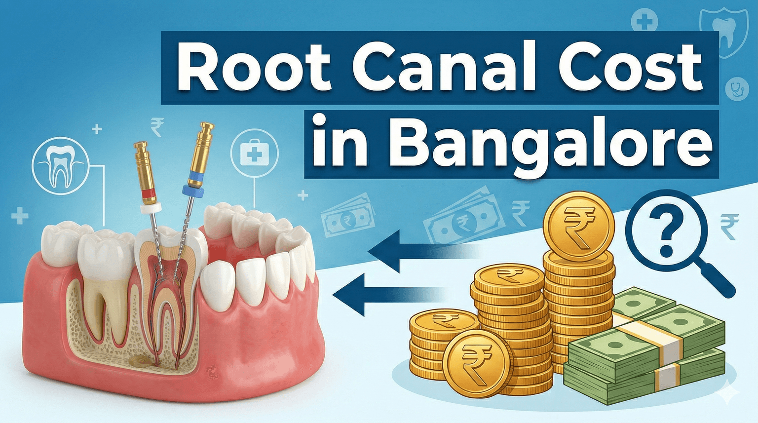 Root Canal Treatment Cost in Bangalore: Complete Guide